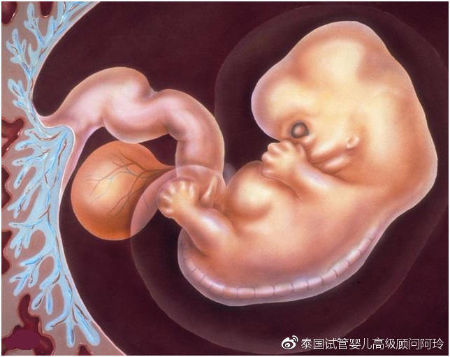 得了腺肌症能自然怀孕吗、能做泰国试管婴儿吗？